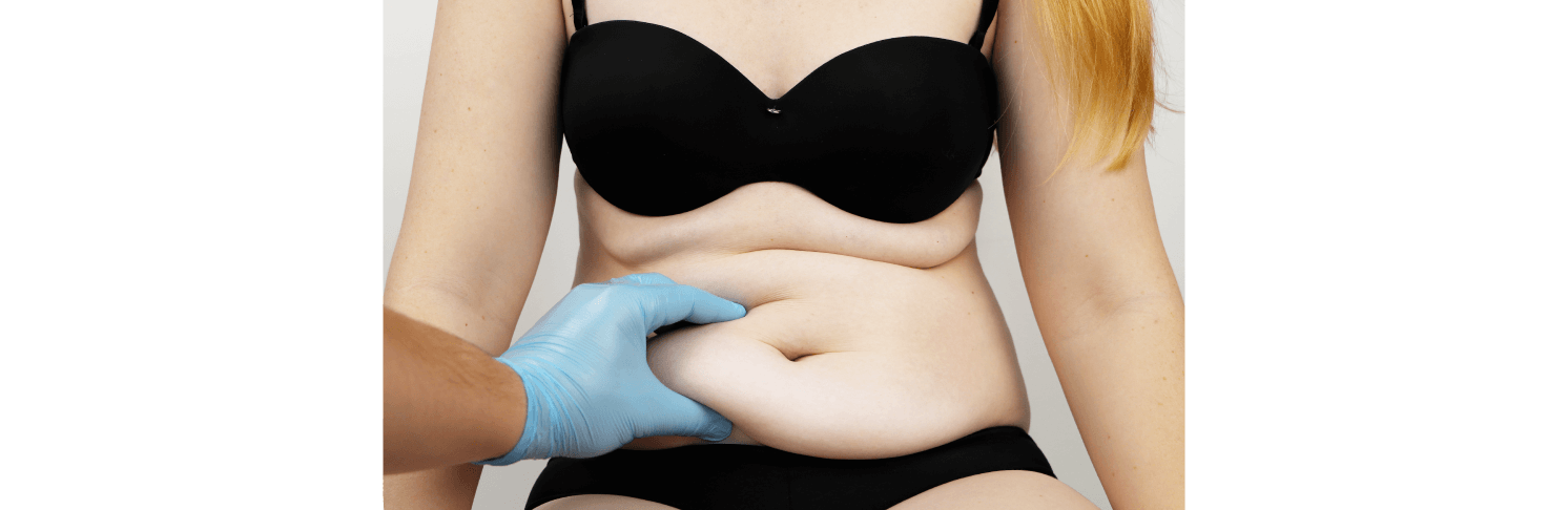 Achieve a Natural Breast Augmentation Look in Staten Island